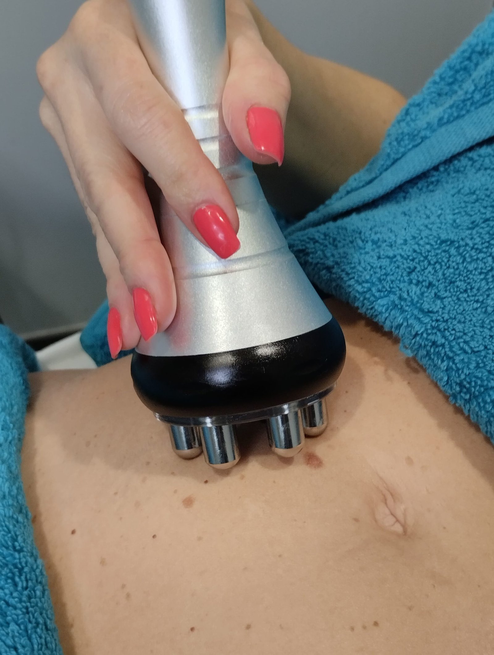 mesoterapia